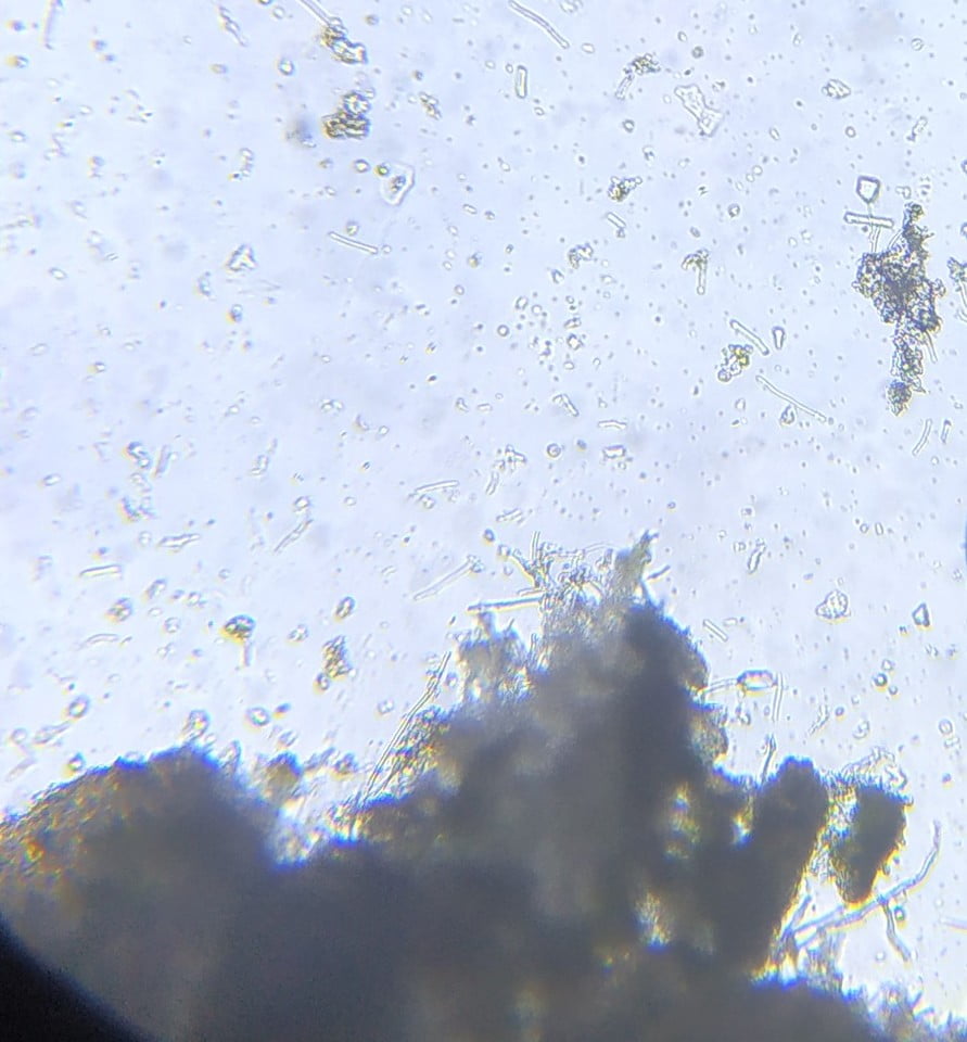 Le lichen au microscope : en vert l'algue au milieu des filaments du champignon